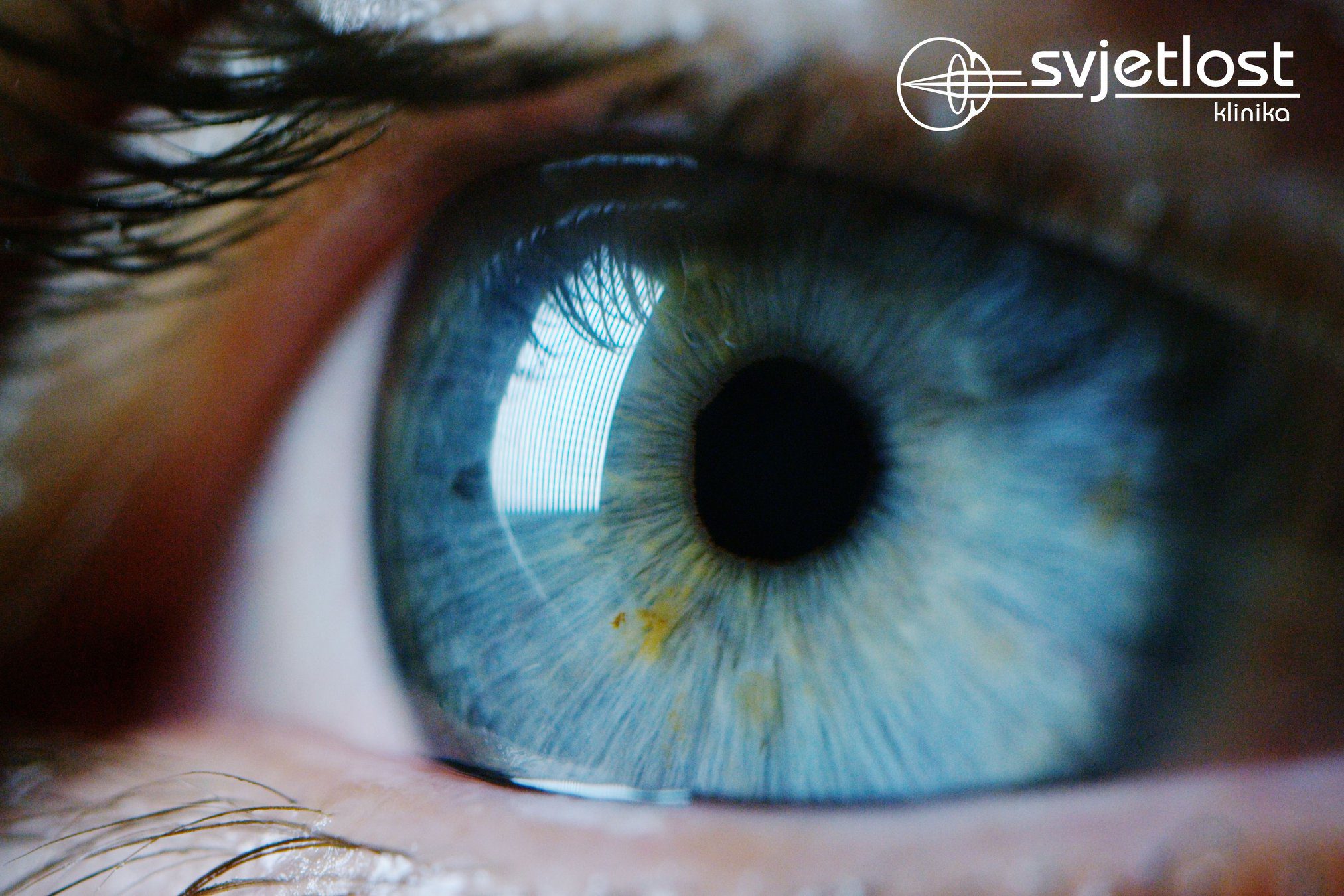 Tamne zavjese, mrljice i bljeskovi u očima – kada se hitno javiti oftalmologu?