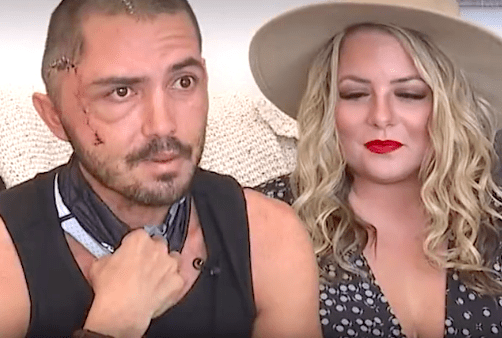 Vatrogasac na Floridi preživio napad aligatora ‘hvatajući ga za zube, jezik i njušku’