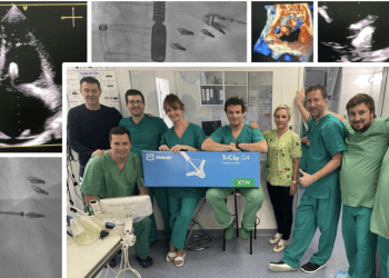 U KBC-u Split po prvi puta obavljen zahvat transkateterskog popravka trikuspidalnog zalistka 