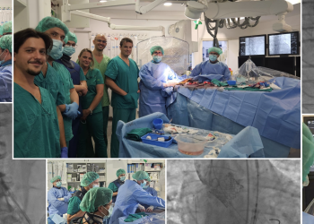 Splitska kardiologija ponovno oduševljava: novo dostignuće u intervencijskom liječenju strukturne bolesti srca